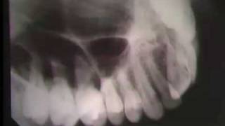 Occlusal Radiography [upl. by Mayram922]