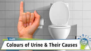 Colours of Urine and their Causes [upl. by Ail]