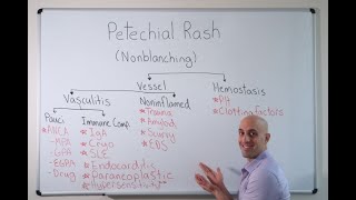 Petechial Rash  Approach [upl. by Roldan]