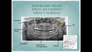 Radiographic Interpretation of Dental Anatomy [upl. by Asined]