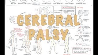 Cerebral Palsy  DETAILED Overview [upl. by Chamkis]