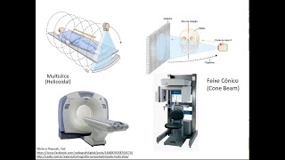 Introdução a Tomografia Computadorizada Parte 1 de 3 [upl. by Estel]