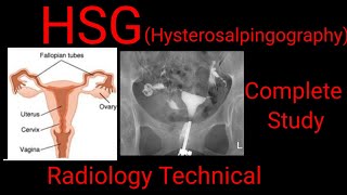 What is Angiography  How Coronary Angiography works UrduHindi [upl. by Rickart746]