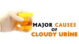 8 Major Causes of Cloudy Urine [upl. by Frank]