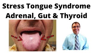 Do THESE 5 Tongue Exercises Now to Speak Better English [upl. by Yarised896]