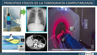 Principios Físicos de la Tomografía Computarizada [upl. by Jeffcott]