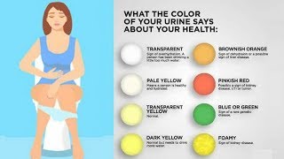 What the color of your urine says about your health [upl. by Llevron826]