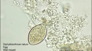 Diphyllobothrium latum egg [upl. by Eserehs]