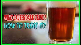 What Causes Dark Urine And How To Treat It  Best Home Remedies [upl. by Jolie]