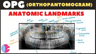 Orthopantomogram OPG Anatomical Landmarks  Panoramic Radiography landmarks  Radiology [upl. by Repsac277]