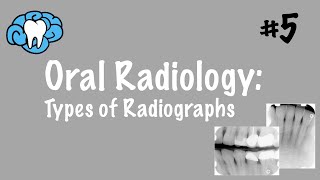 Oral Radiology  Types of Radiographs  INBDE ADAT [upl. by Rustin]