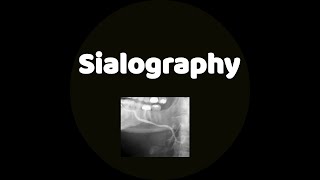 Sialography [upl. by Oidiple384]