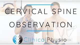 Cervical Spine Observation  Clinical Physio Premium [upl. by Barkley]