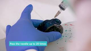 Fresh Tissue Sampling  Fine Needle Aspirate FNA Technique [upl. by Bork]