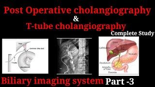 ERCP Procedure  Endoscopic retrograde cholangiopancreatography  biliary imaging system part 3 [upl. by Chevy]