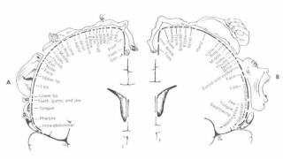 Difference Between Aphasia and Dysarthria [upl. by Ahsinit]