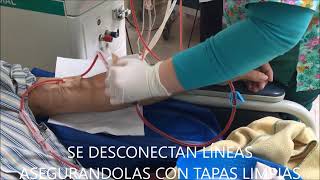 IEDYT UNIDIAL Conexion y Desconexion a Hemodialisis por medio de fistula arteriovenosa [upl. by Sabir]