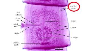 Diphyllobothrium Latum [upl. by Verda]