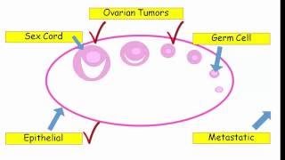 What You Need to Know About Ovarian Cysts [upl. by Bilow376]