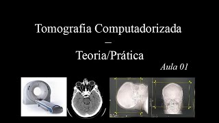 Curso de Tomografia  Aula 1 Gantry Scout FOV Matriz Pixel [upl. by Brathwaite696]