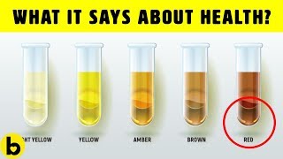 What The Color Of Your Urine Says About Your Health [upl. by Nitsyrk]