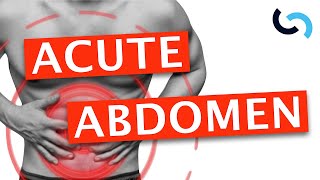 Acute Abdomen  Diagnosis and Management [upl. by Hubert]