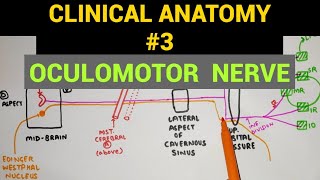 Trochlear Nerve Palsy Rapid Review [upl. by Denie]