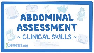 Abdominal Assessment Clinical Skills [upl. by Philipp54]