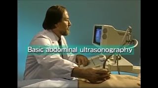 How to do abdominal ultrasound examination [upl. by Carrnan329]