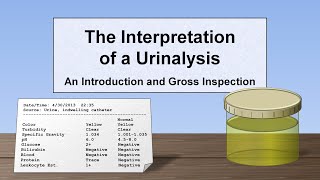 Interpretation of the Urinalysis Part 1  Introduction and Inspection [upl. by Primo]